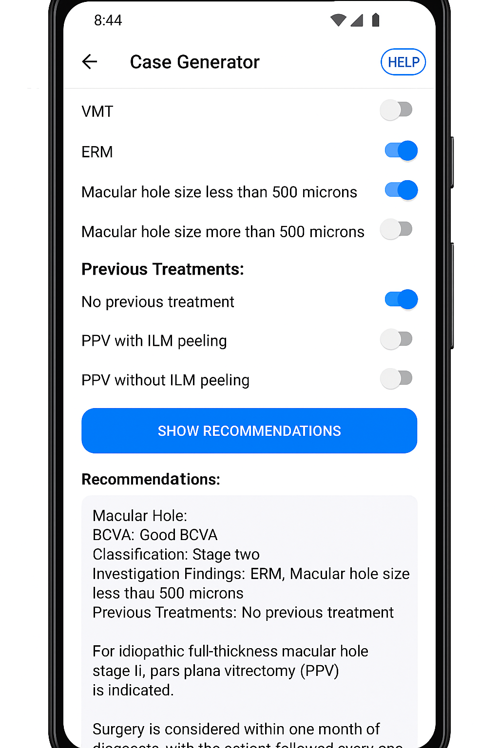 Case Generator preview